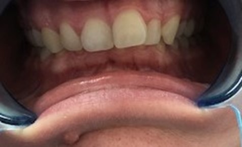 Orthodontie_13