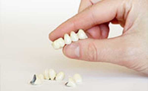 Prothèse dentaire sur implant Paris 15