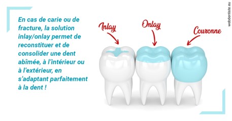 https://dr-feredj-elisabeth.chirurgiens-dentistes.fr/L'INLAY ou l'ONLAY