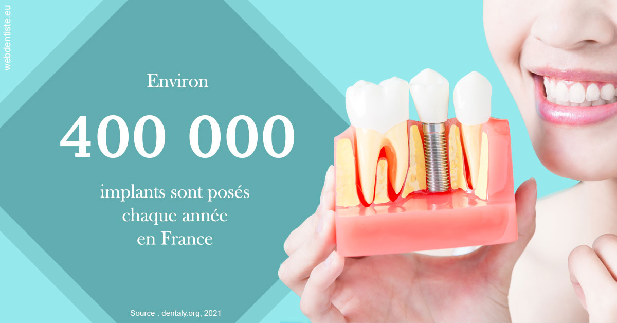 https://dr-feredj-elisabeth.chirurgiens-dentistes.fr/Pose d'implants en France 2