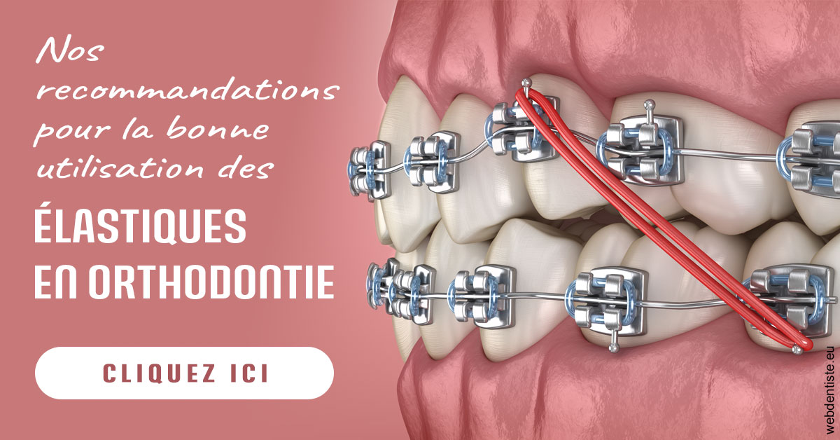 https://dr-feredj-elisabeth.chirurgiens-dentistes.fr/Elastiques orthodontie 2