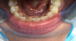 Orthodontie_10