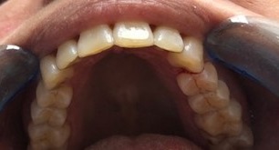 Orthodontie_9
