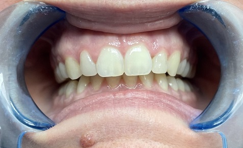 Orthodontie_14