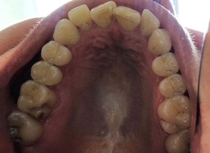 Orthodontie_7