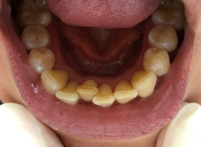 Orthodontie_8